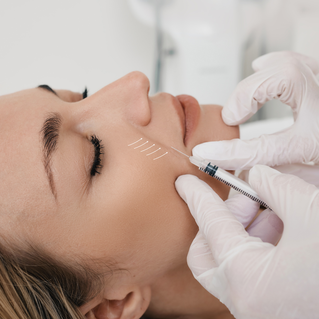 woman getting ez gel filler