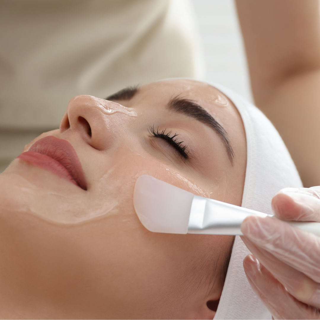 woman getting chemical peel