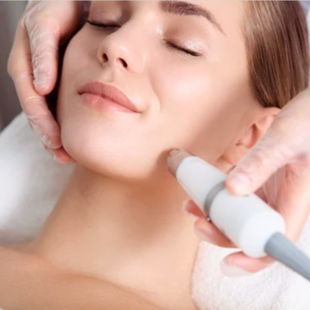 woman receiving fotona laser treatment