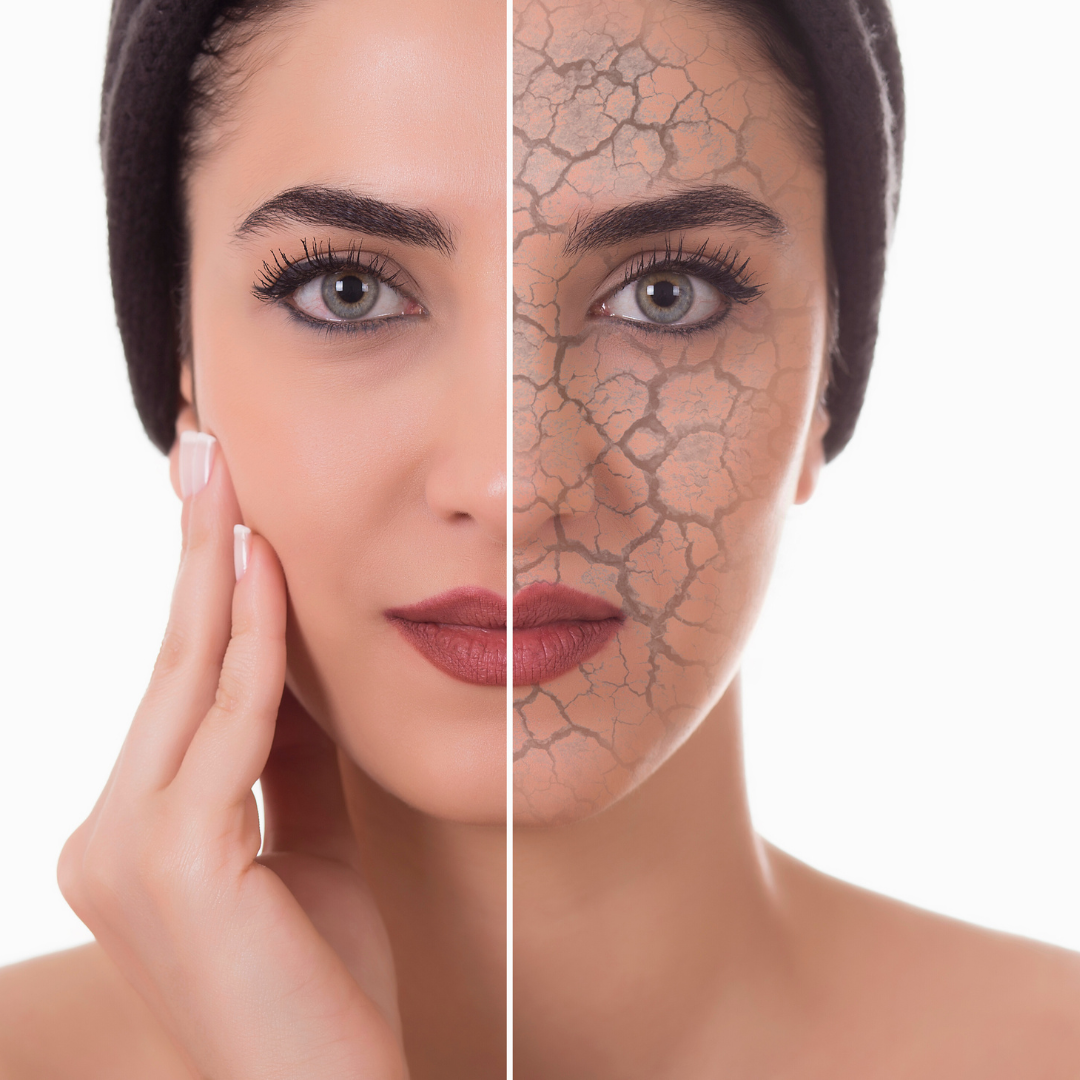 Woman with glowing skin showing results of proper hydration vs moisture for skin