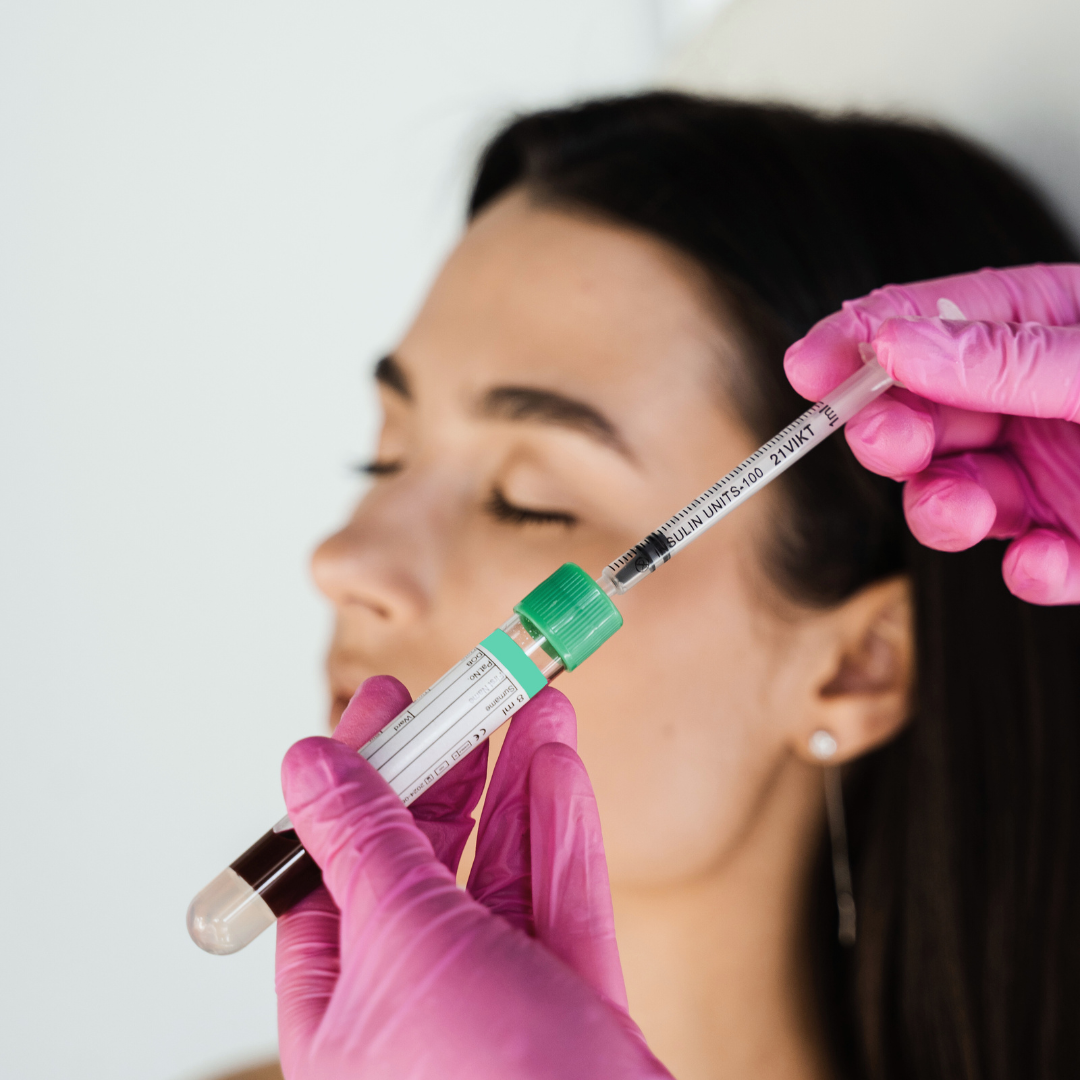 Close up PRP treatment for under eyes