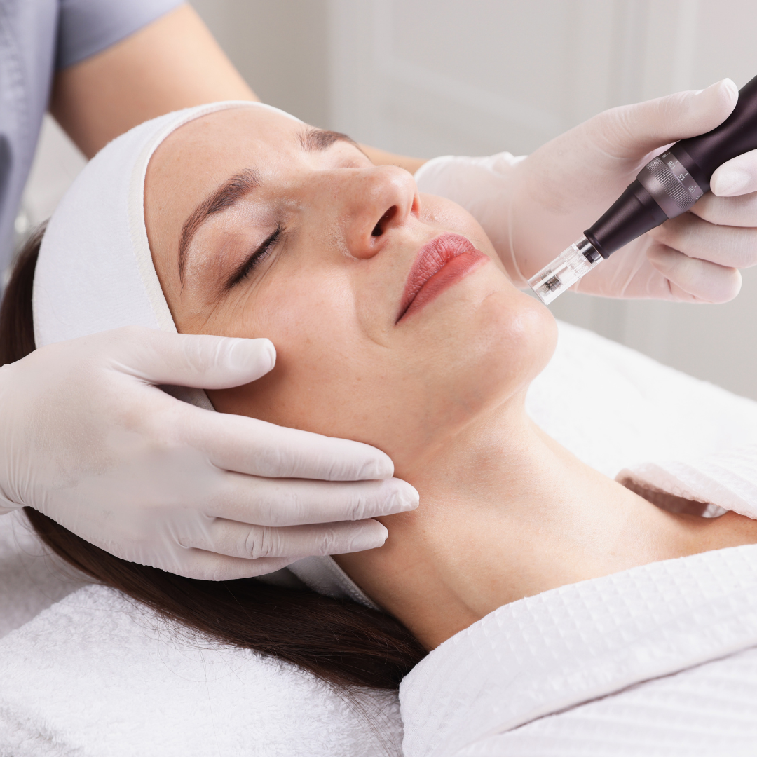 woman getting microneedling to improve skin texture